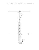 METHOD FOR PROVIDING SURGICAL ACCESS diagram and image