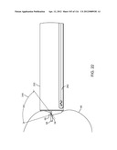 METHOD FOR PROVIDING SURGICAL ACCESS diagram and image