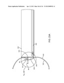 METHOD FOR PROVIDING SURGICAL ACCESS diagram and image