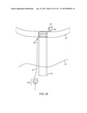 METHOD FOR PROVIDING SURGICAL ACCESS diagram and image