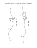 METHOD FOR PROVIDING SURGICAL ACCESS diagram and image