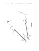 METHOD FOR PROVIDING SURGICAL ACCESS diagram and image