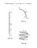 METHOD FOR PROVIDING SURGICAL ACCESS diagram and image