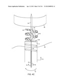 METHOD FOR PROVIDING SURGICAL ACCESS diagram and image