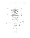 METHOD FOR PROVIDING SURGICAL ACCESS diagram and image