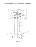 METHOD FOR PROVIDING SURGICAL ACCESS diagram and image