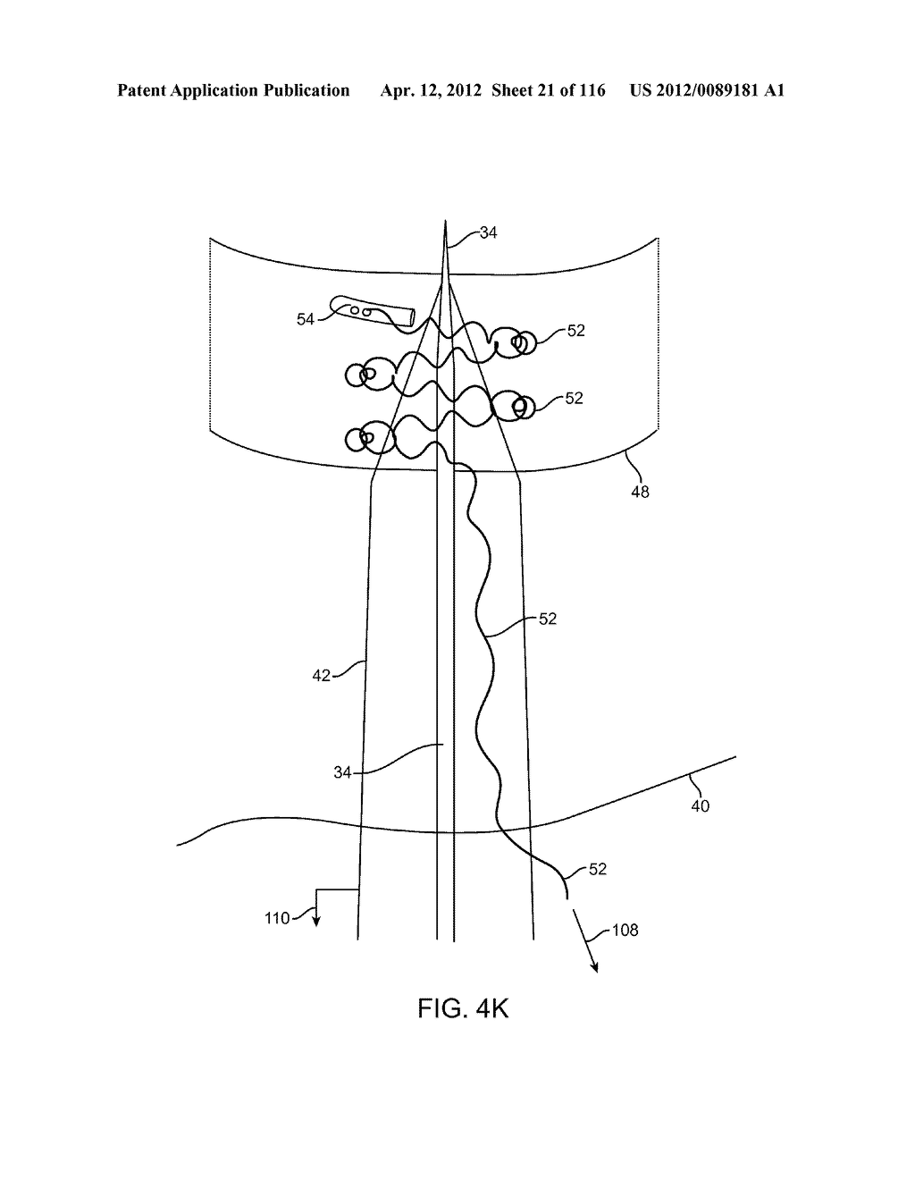 METHOD FOR PROVIDING SURGICAL ACCESS - diagram, schematic, and image 22