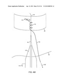 METHOD FOR PROVIDING SURGICAL ACCESS diagram and image