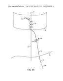 METHOD FOR PROVIDING SURGICAL ACCESS diagram and image