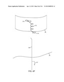 METHOD FOR PROVIDING SURGICAL ACCESS diagram and image