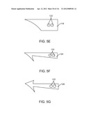 METHOD FOR PROVIDING SURGICAL ACCESS diagram and image