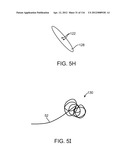 METHOD FOR PROVIDING SURGICAL ACCESS diagram and image