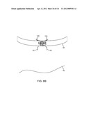 METHOD FOR PROVIDING SURGICAL ACCESS diagram and image