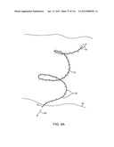 METHOD FOR PROVIDING SURGICAL ACCESS diagram and image