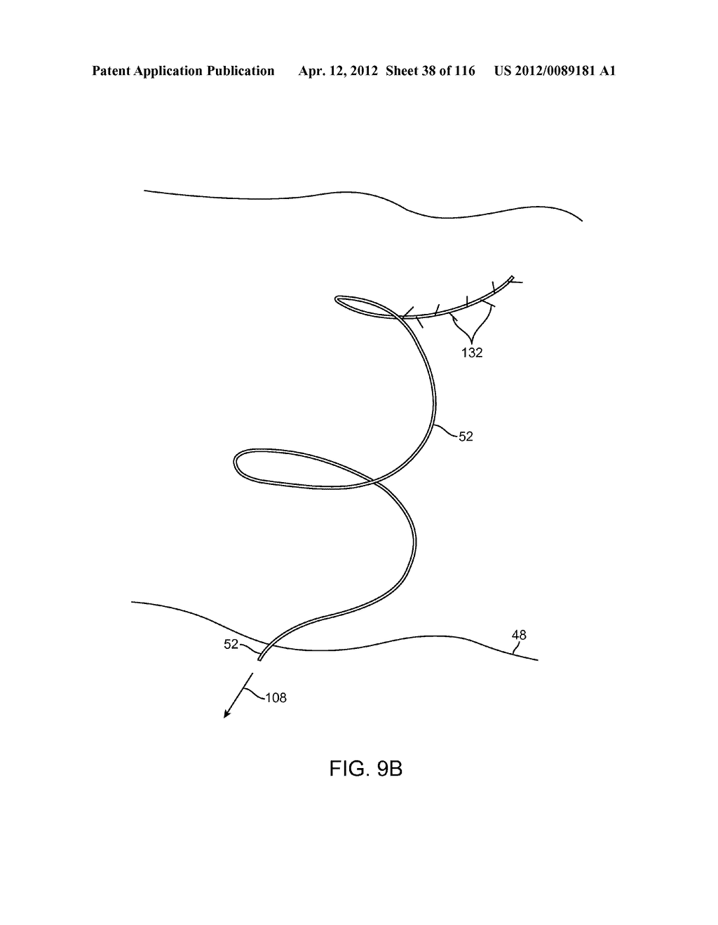 METHOD FOR PROVIDING SURGICAL ACCESS - diagram, schematic, and image 39