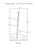 METHOD FOR PROVIDING SURGICAL ACCESS diagram and image