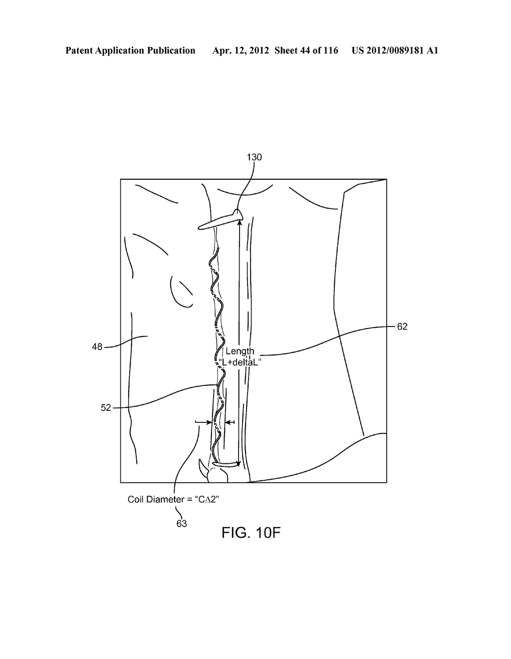 METHOD FOR PROVIDING SURGICAL ACCESS - diagram, schematic, and image 45