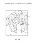 METHOD FOR PROVIDING SURGICAL ACCESS diagram and image