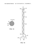 METHOD FOR PROVIDING SURGICAL ACCESS diagram and image