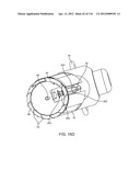 METHOD FOR PROVIDING SURGICAL ACCESS diagram and image