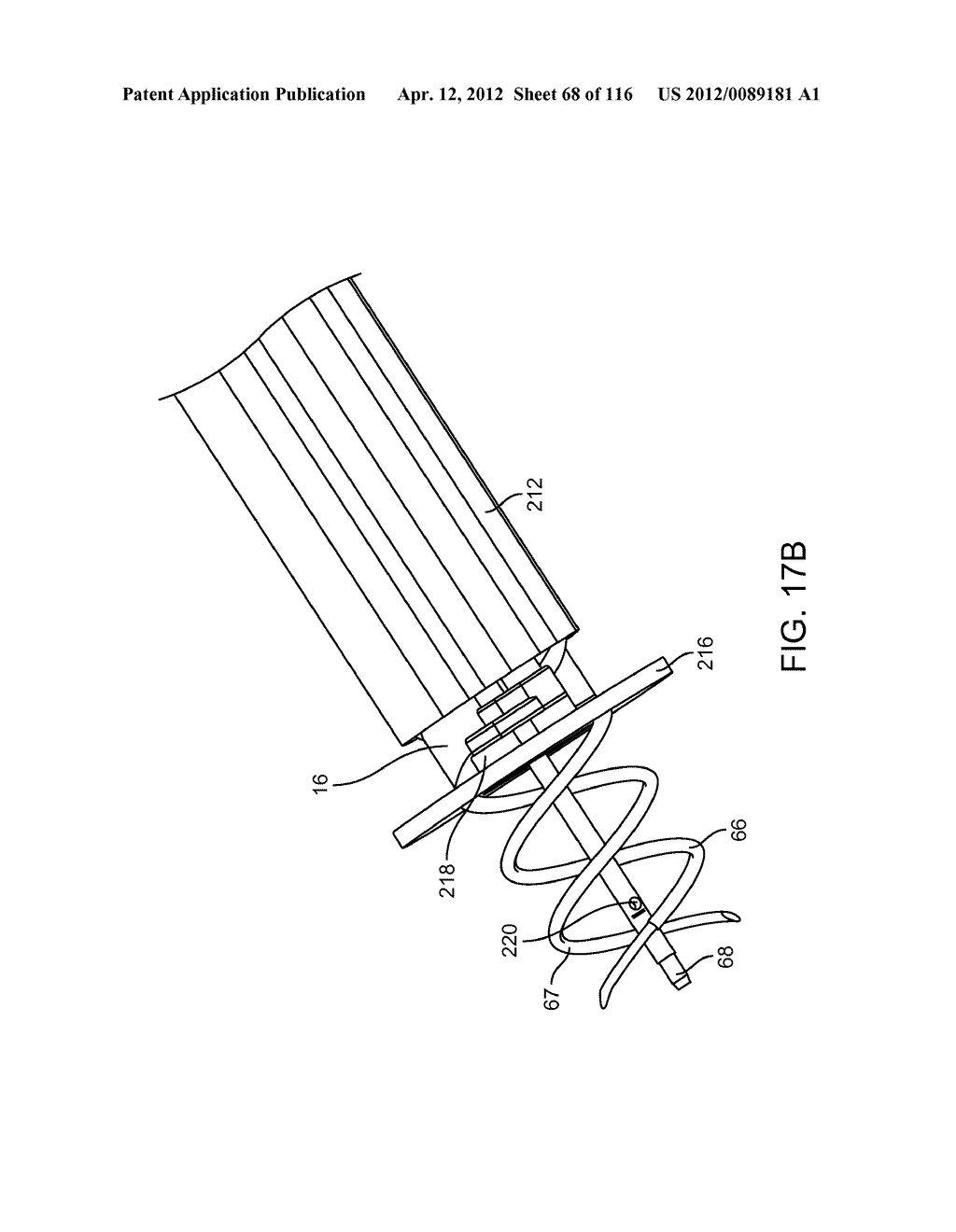 METHOD FOR PROVIDING SURGICAL ACCESS - diagram, schematic, and image 69