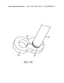 METHOD FOR PROVIDING SURGICAL ACCESS diagram and image