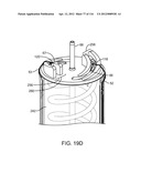 METHOD FOR PROVIDING SURGICAL ACCESS diagram and image