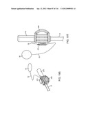 METHOD FOR PROVIDING SURGICAL ACCESS diagram and image