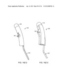 METHOD FOR PROVIDING SURGICAL ACCESS diagram and image