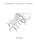 METHOD FOR PROVIDING SURGICAL ACCESS diagram and image