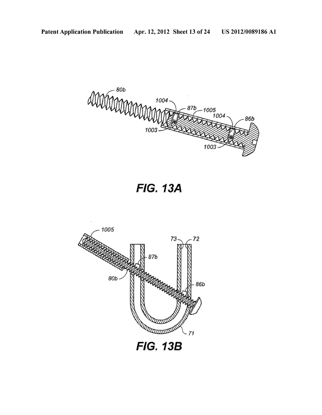 DEVICE AND METHOD FOR CORRECTING A SPINAL DEFORMITY - diagram, schematic, and image 14