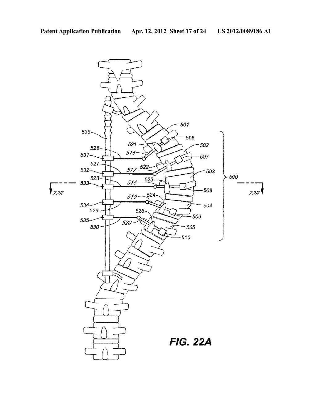 DEVICE AND METHOD FOR CORRECTING A SPINAL DEFORMITY - diagram, schematic, and image 18