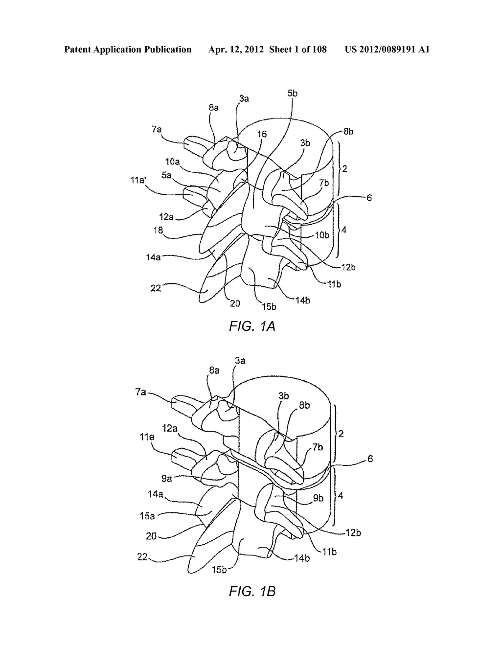 METHODS FOR STABILIZING BONE STRUCTURES - diagram, schematic, and image 02