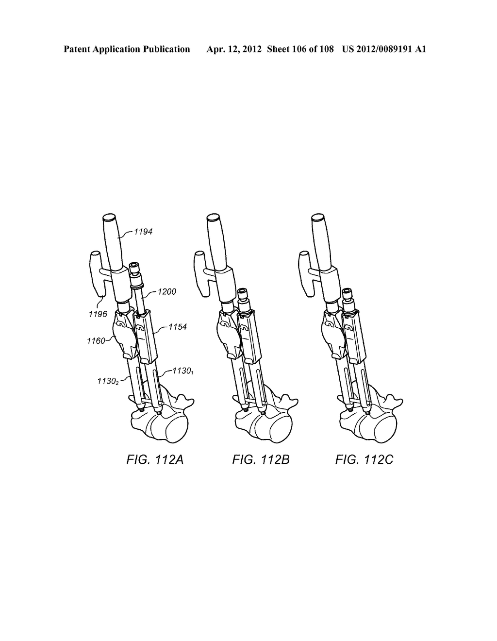 METHODS FOR STABILIZING BONE STRUCTURES - diagram, schematic, and image 107