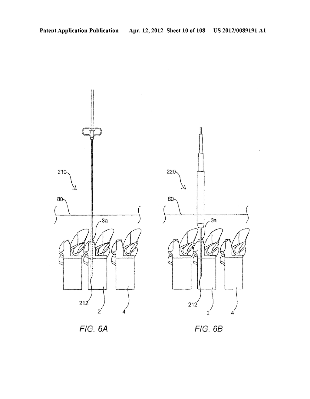 METHODS FOR STABILIZING BONE STRUCTURES - diagram, schematic, and image 11