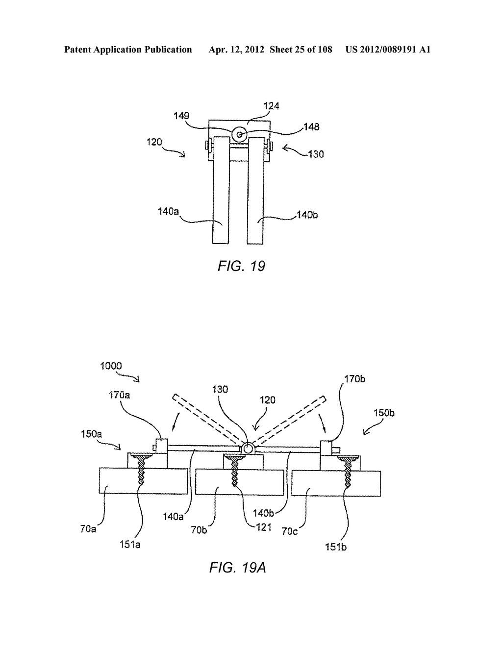 METHODS FOR STABILIZING BONE STRUCTURES - diagram, schematic, and image 26