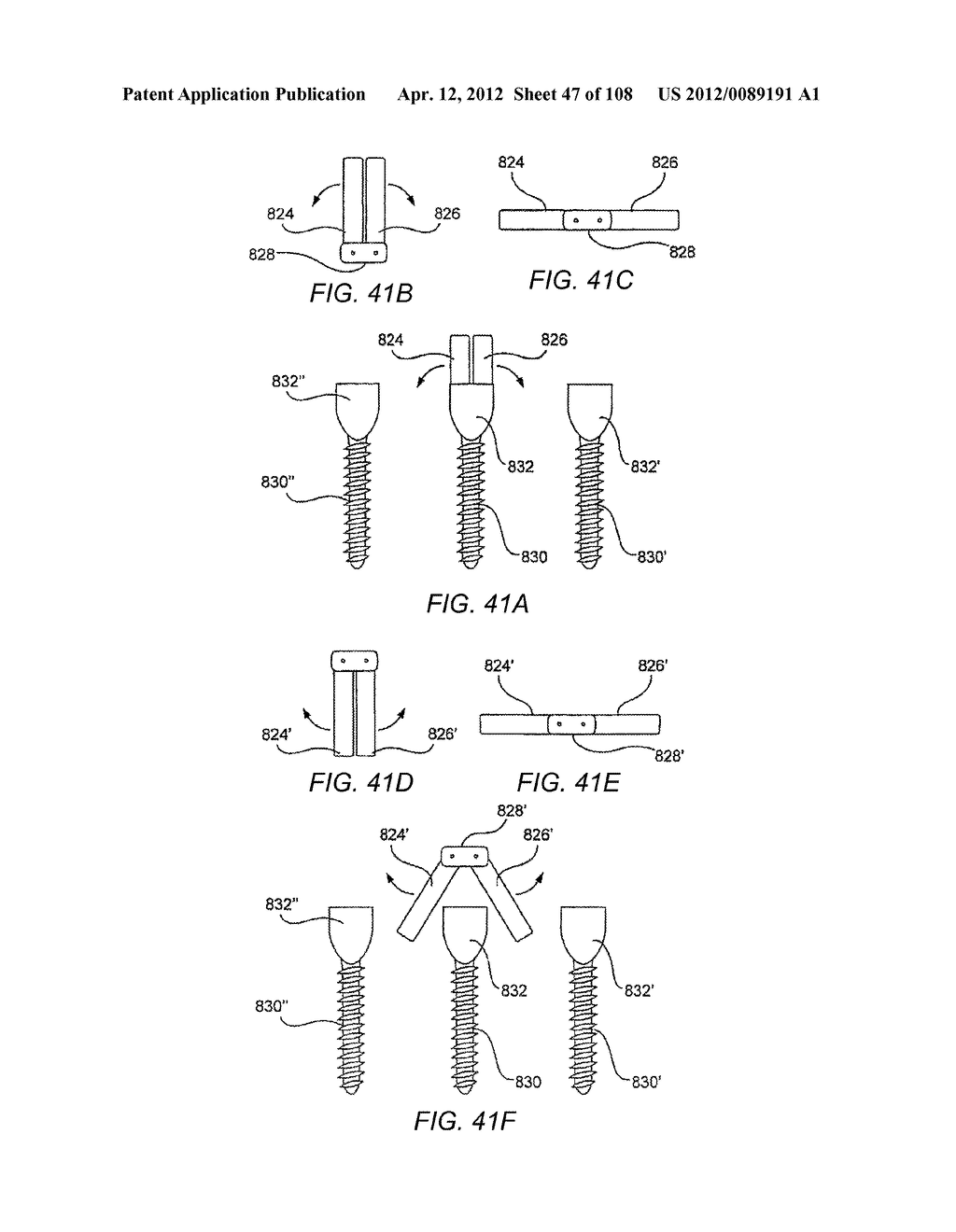 METHODS FOR STABILIZING BONE STRUCTURES - diagram, schematic, and image 48