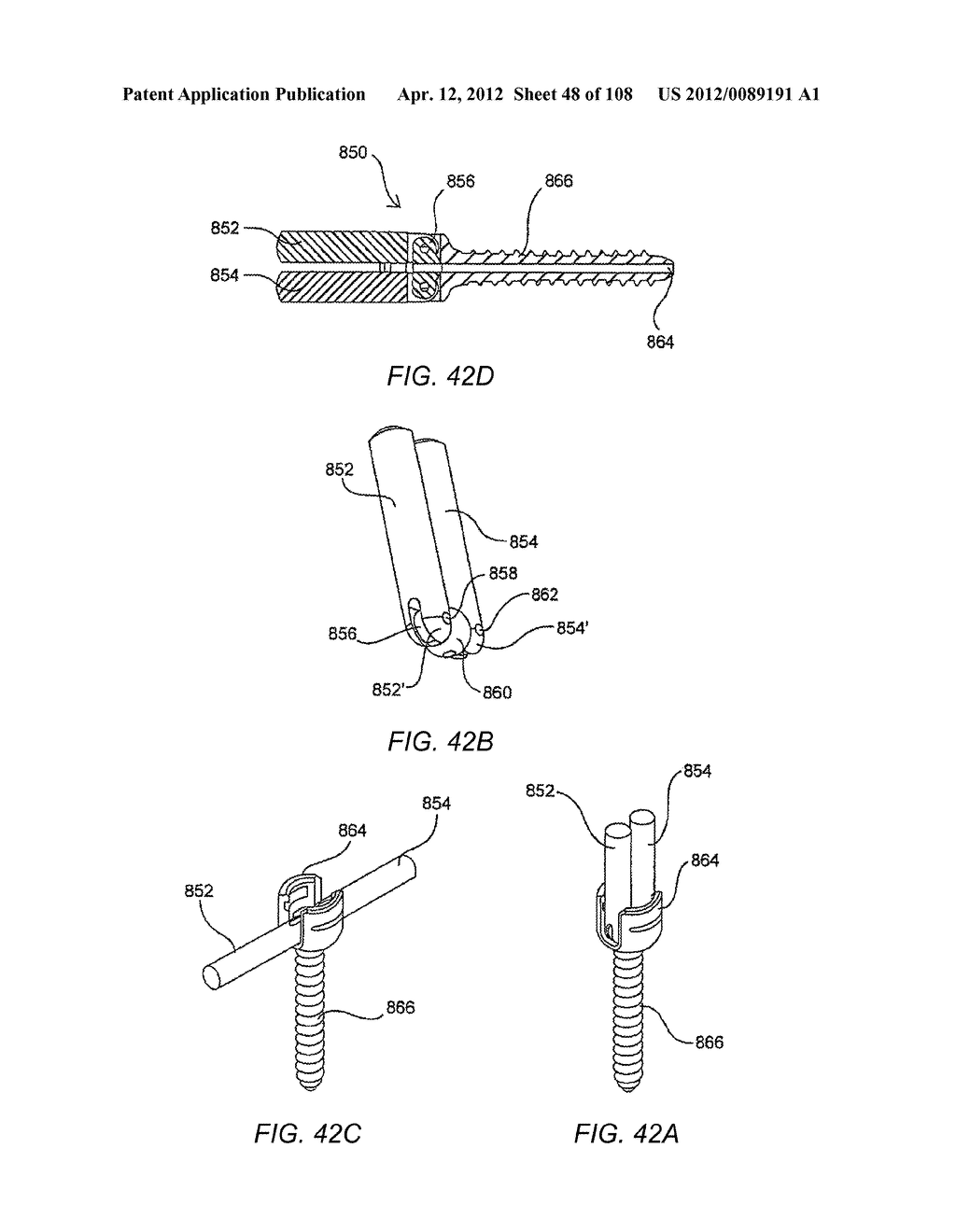 METHODS FOR STABILIZING BONE STRUCTURES - diagram, schematic, and image 49