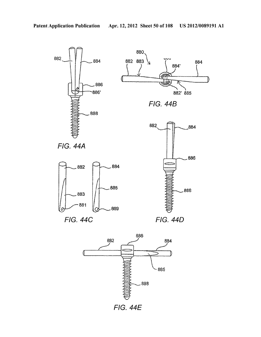 METHODS FOR STABILIZING BONE STRUCTURES - diagram, schematic, and image 51