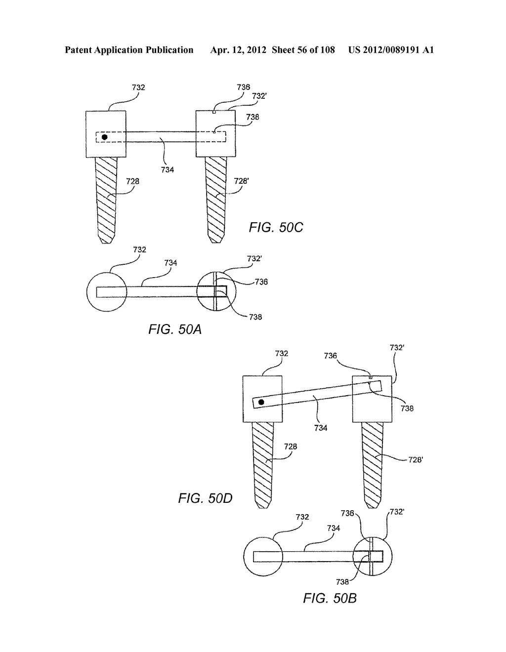 METHODS FOR STABILIZING BONE STRUCTURES - diagram, schematic, and image 57