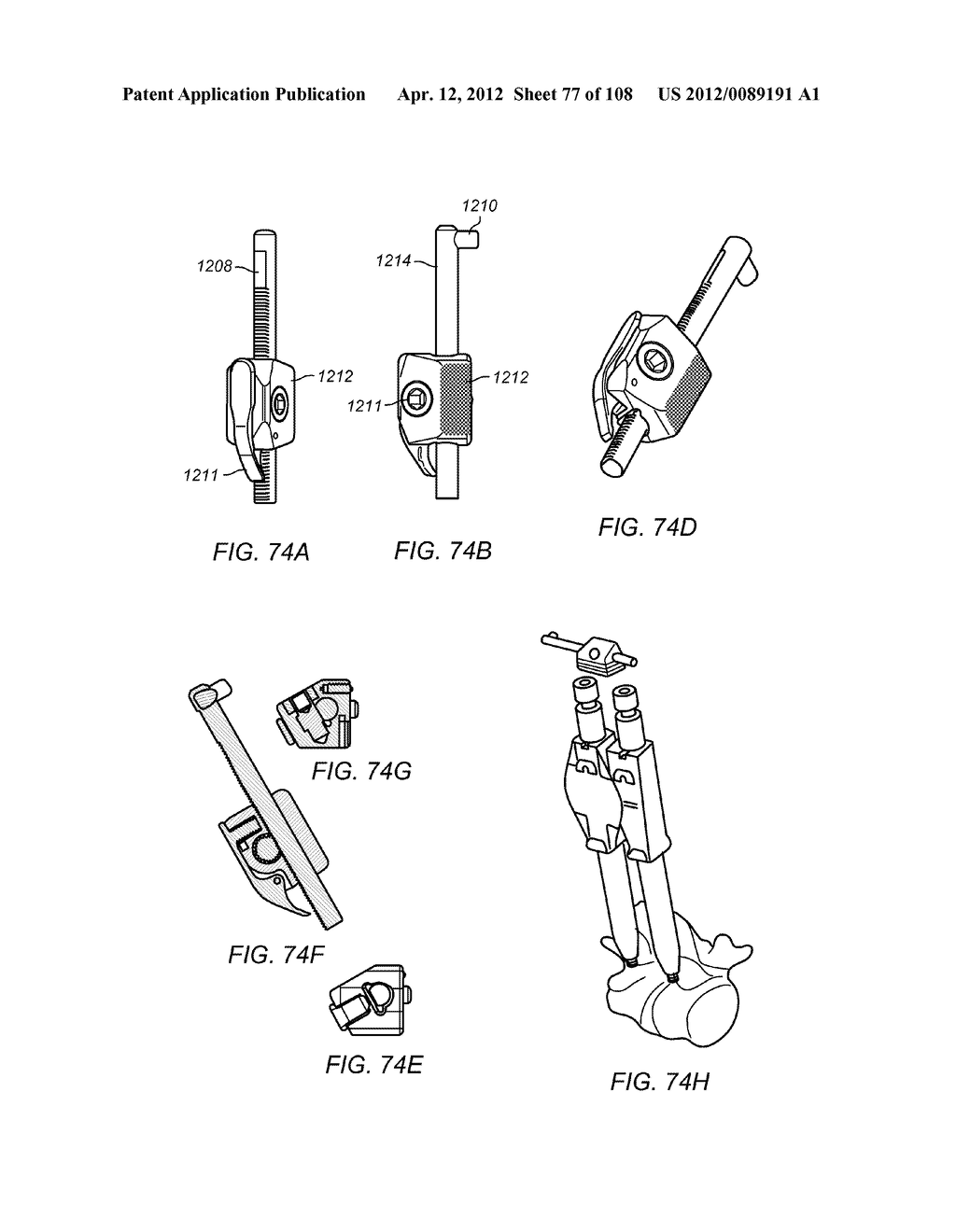 METHODS FOR STABILIZING BONE STRUCTURES - diagram, schematic, and image 78