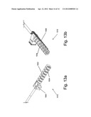 ELECTRICAL CONNECTIONS FOR USE IN IMPLANTABLE MEDICAL DEVICES diagram and image