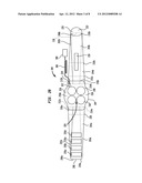 System for Therapeutic Application of Heat diagram and image