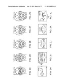 METHODS AND APPARATUS FOR CRYOGENICALLY TREATING MULTIPLE TISSUE SITES     WITH A SINGLE PUNCTURE diagram and image