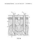 METHODS AND APPARATUS FOR CRYOGENICALLY TREATING MULTIPLE TISSUE SITES     WITH A SINGLE PUNCTURE diagram and image