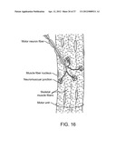 METHODS AND APPARATUS FOR CRYOGENICALLY TREATING MULTIPLE TISSUE SITES     WITH A SINGLE PUNCTURE diagram and image