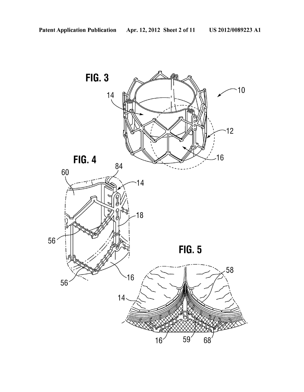 BAR-LESS COMMISSURE ATTACHMENT FOR PROSTHETIC VALVE - diagram, schematic, and image 03