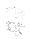 LORDOTIC EXPANDABLE INTERBODY IMPLANT AND METHOD diagram and image