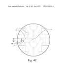 LORDOTIC EXPANDABLE INTERBODY IMPLANT AND METHOD diagram and image