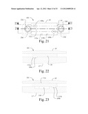 LORDOTIC EXPANDABLE INTERBODY IMPLANT AND METHOD diagram and image